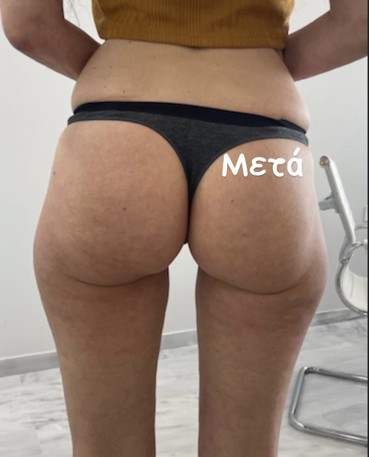 Μετά